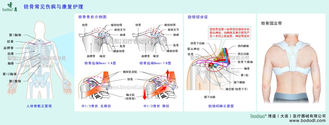 鎖骨の主な疾患