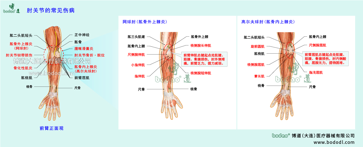 肘關(guān)節(jié)傷病的類型與癥狀