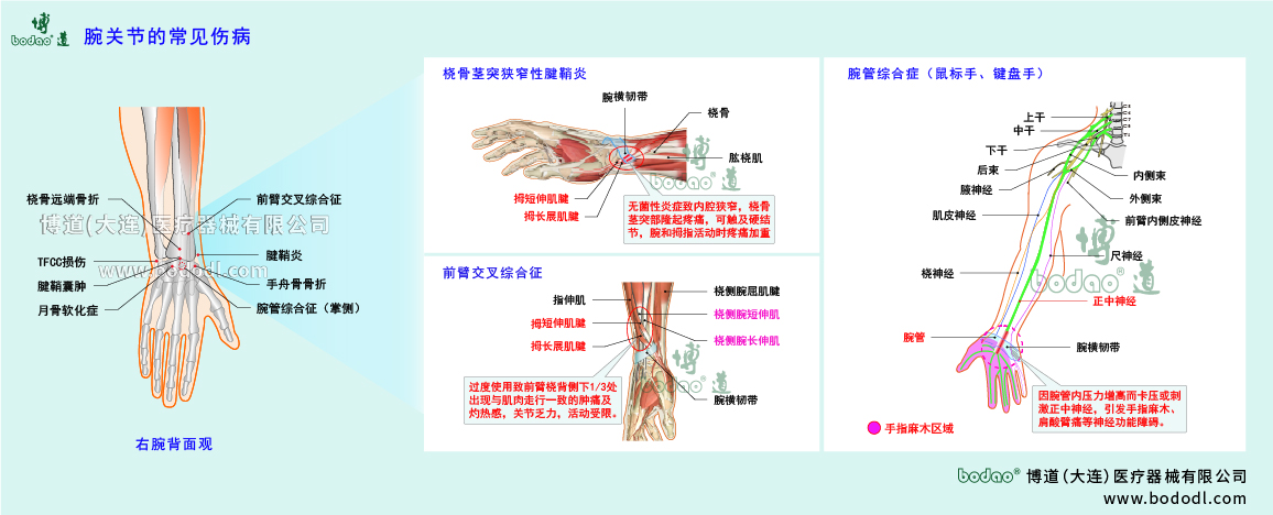 腕關(guān)節(jié)傷病的類型與癥狀