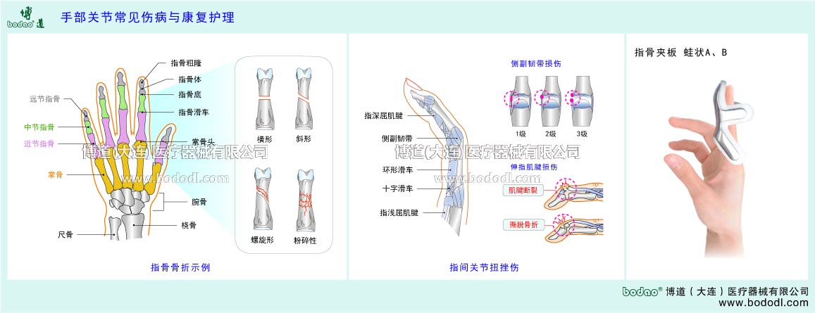 指関節(jié)の主な疾患