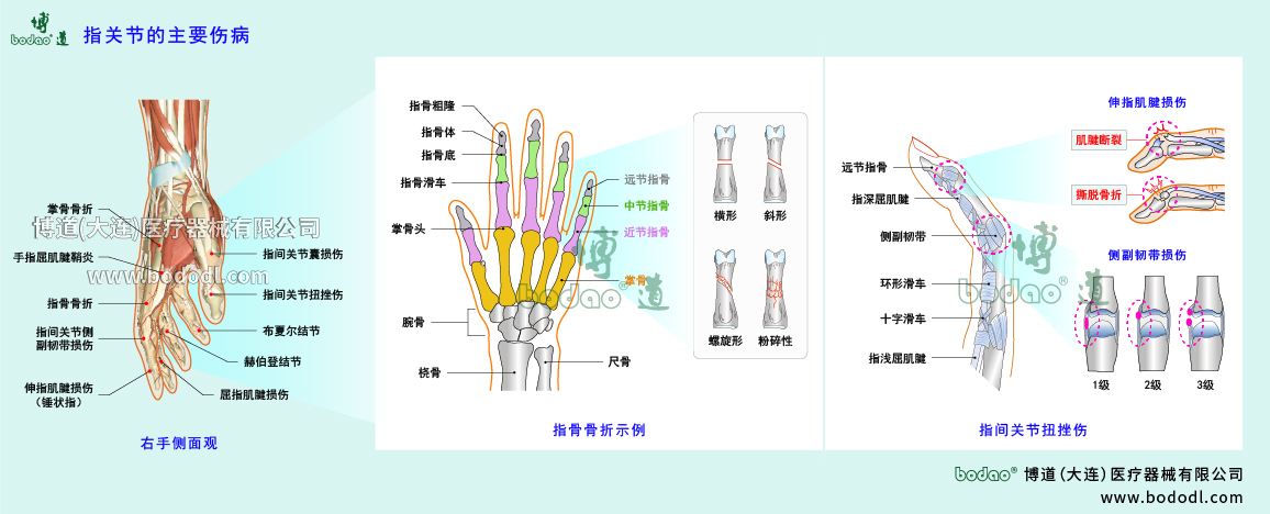 指關(guān)節(jié)傷病的類型與癥狀