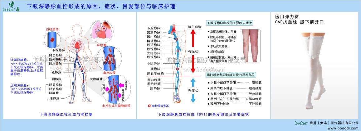 下肢深靜脈血栓形成與臨床護(hù)理