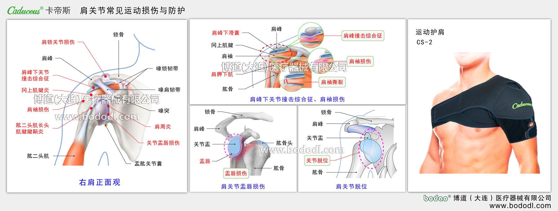 肩関節(jié)の主なスポーツ損傷